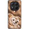 TPU+PC чехол Prisma Fluffie для Xiaomi Redmi Note 14 Pro 4G Dream